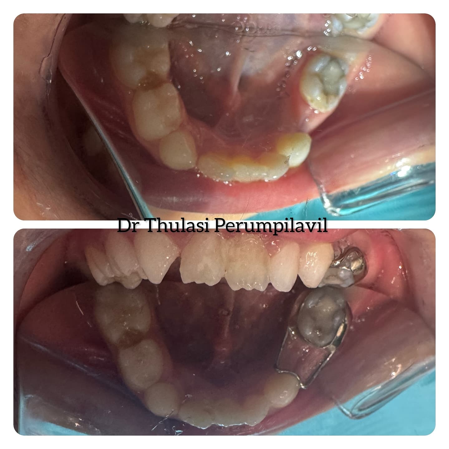Before & After Case 1