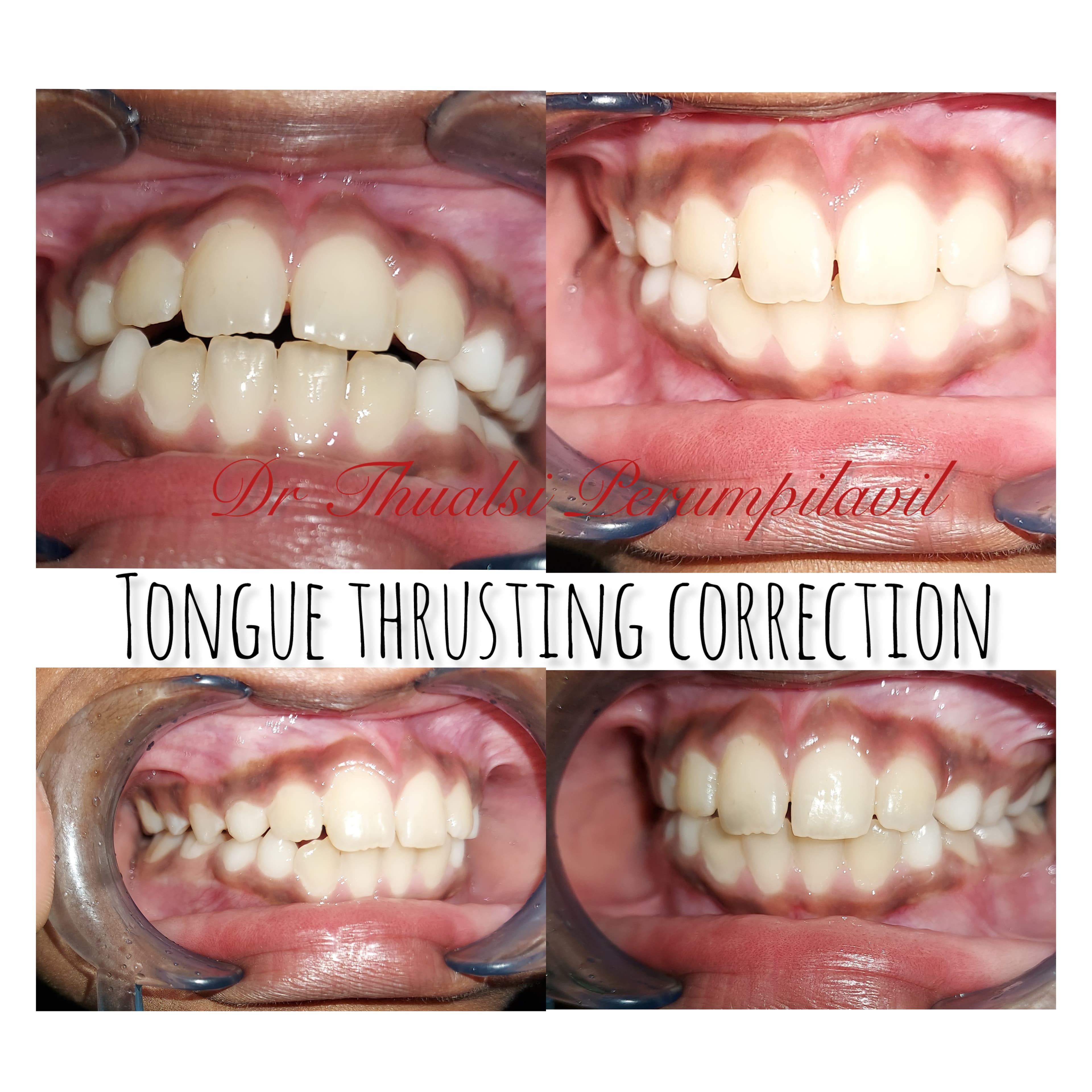 Before & After Case 4