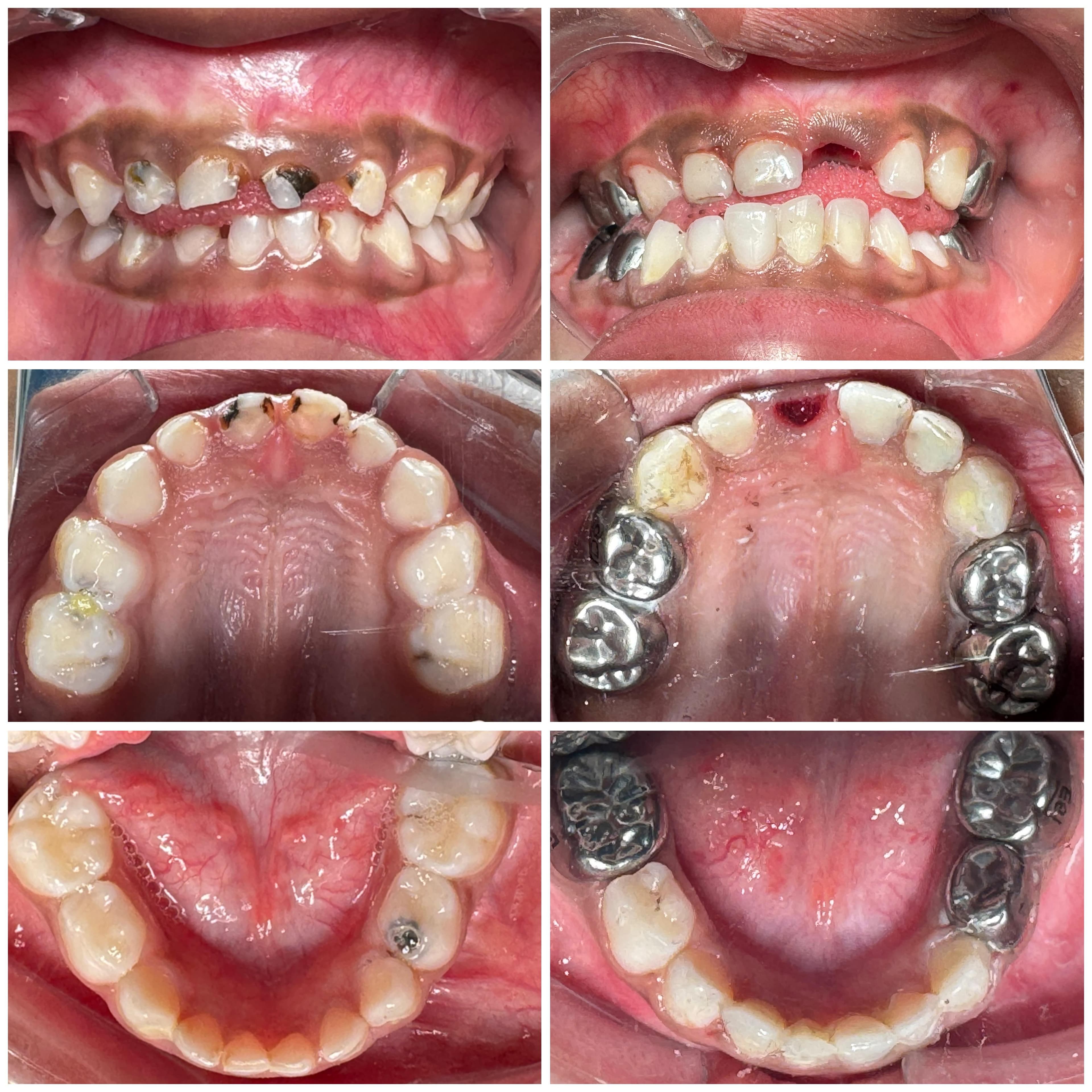 Before & After Case 5